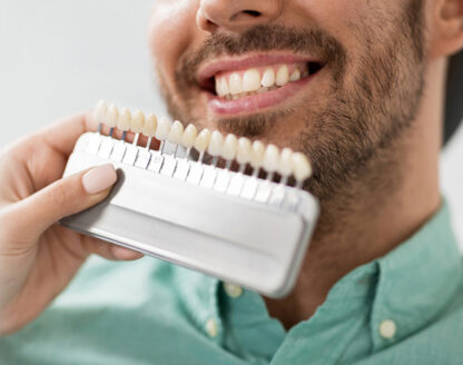What type of Dental Veneers are best- 