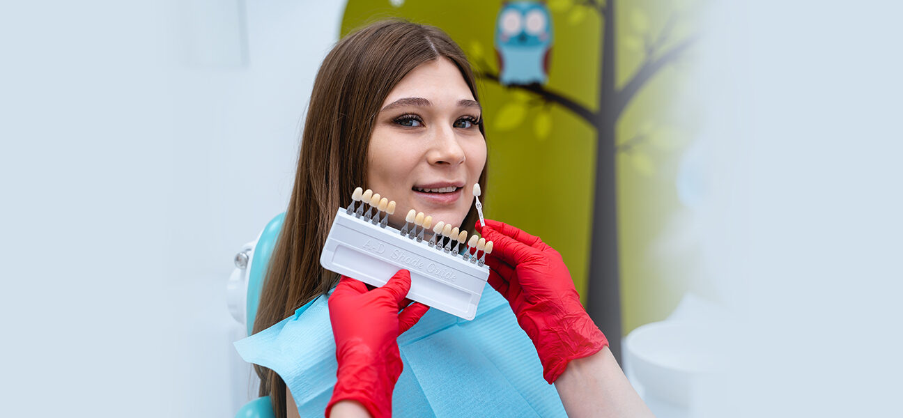 dental veneers (2)