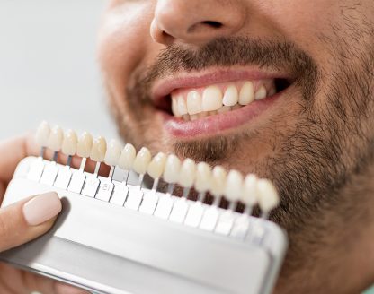 What Are Dental Veneers and How Do They Work? 